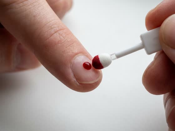Touch the drop — The white tip touches the side of the drop and draws the blood up by itself.